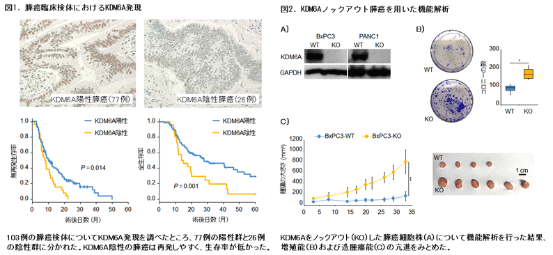 図1．膵癌臨床検体におけるKDM6A発現　図2．KDM6Aノックアウト膵癌を用いた機能解析　