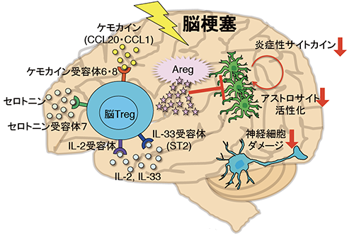 脳梗塞慢性期において神経症状を回復させる新規脳内t細胞を発見 抗うつ剤が制御性t細胞を増やし脳梗塞の症状を緩和 国立研究開発法人日本医療研究開発機構
