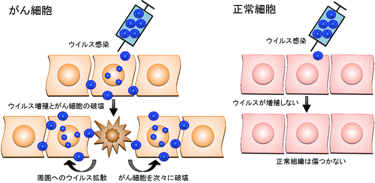 正常細胞に感染した遺伝子組換えウイルスは増殖できないような仕組みを備えているため、正常組織は傷つかない