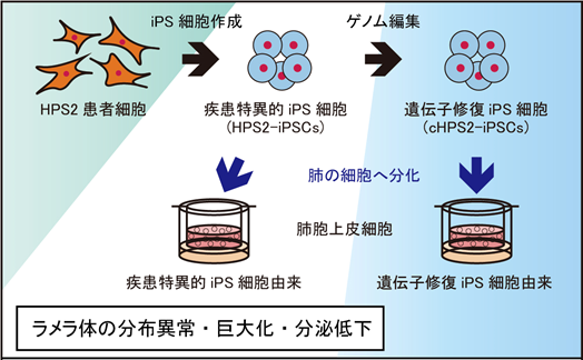 iPS細胞を用いて遺伝性間質性肺炎の病態解析に成功