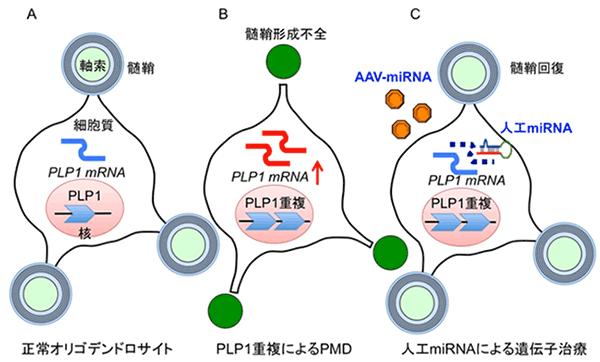 人工マイクロRNA（人工miRNA）により過剰な遺伝子発現を抑制する新規の遺伝子治療法を開発