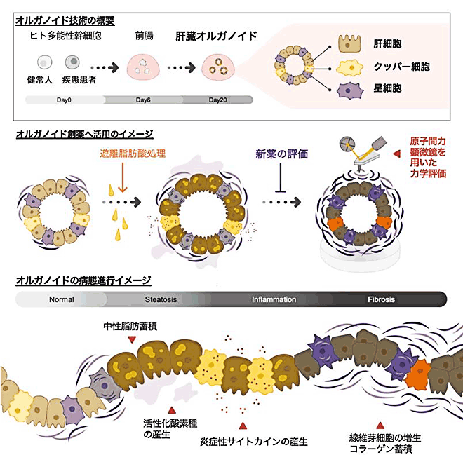 ヒューマンオルガノイド技術による炎症・線維化病態の再現に成功!