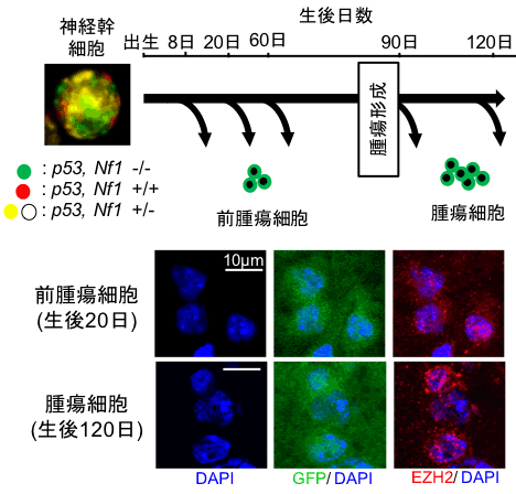極めて難治性の腫瘍である神経膠腫に対する有望な治療法を発見!