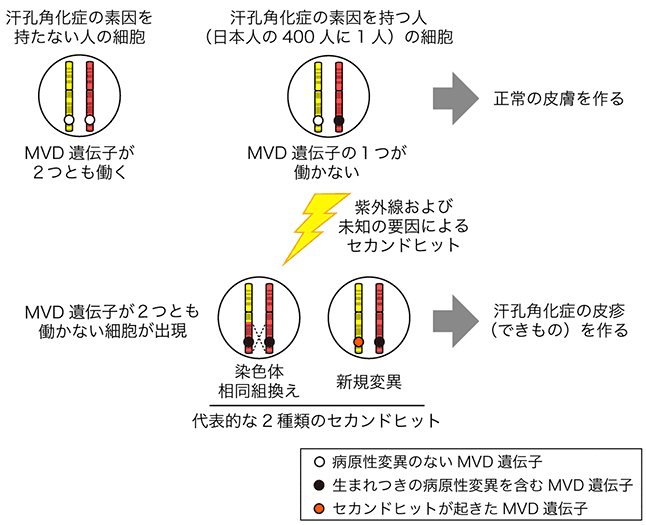 汗孔角化症の発症メカニズムを解明～日本人の400人に1人が生まれつき発症素因を持つことが明らかに～