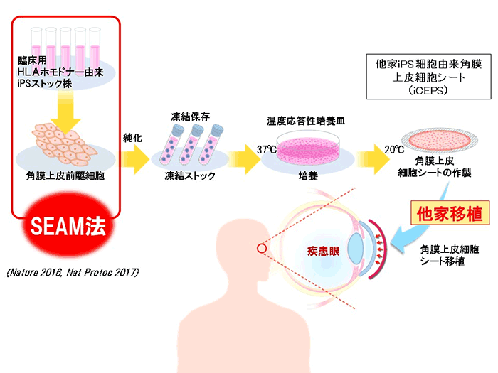 SEAM法の図