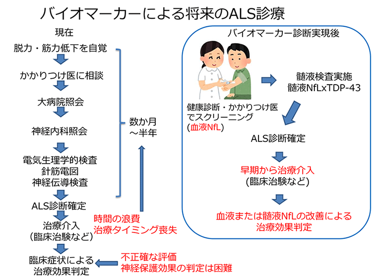 Als 初期 症状