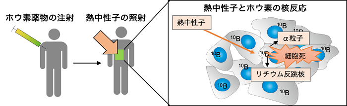 「スライムの化学」を利用した第5のがん治療法