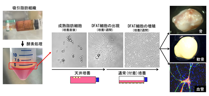 患者自身の脂肪細胞から作られる「DFAT細胞」を用いて世界初の血管再生医療の臨床研究を開始 説明図1 詳細は本文中に記載