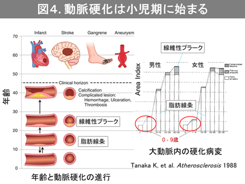 図4．動脈硬化は小児期に始まる
