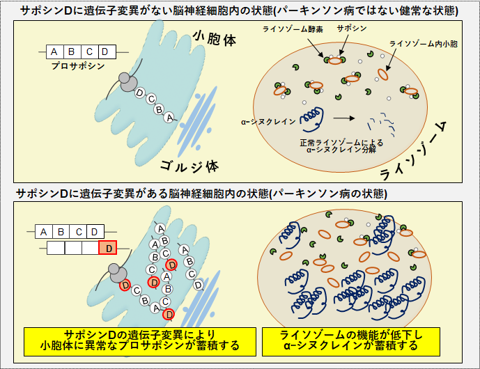 ライソゾーム病の原因遺伝子がパーキンソン病の発症に関わることを発見