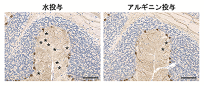 神経難病ポリグルタミン病の新しい治療薬候補を発見 L アルギニンのタンパク質構造安定化作用による凝集抑制効果 国立研究開発法人日本医療研究開発機構