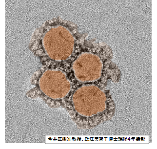 新型コロナウイルス感染症（COVID-19）の病態解明／予防・治療法の開発