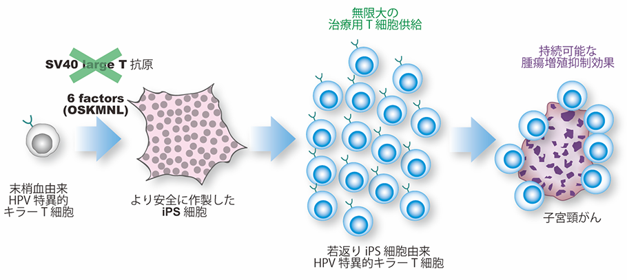 iPS細胞から子宮頸がんの増殖を抑える免疫キラーT細胞の作製に成功