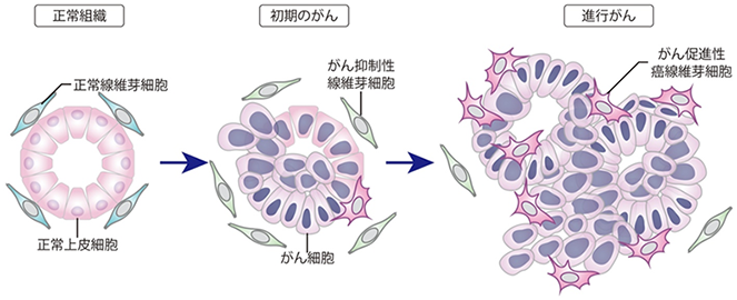 大腸がん細胞の周囲で増える正常細胞の多様性を解明 転移性大腸がんにおいてがん細胞の周囲環境を変える新規治療法の開発に期待 国立研究開発法人日本医療研究開発機構