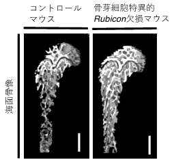 オートファジーにより骨粗鬆症が抑制される～骨芽細胞がオートファジーによって活性化するメカニズムを解明～