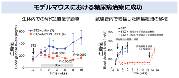 膵島細胞移植とは何ですか?