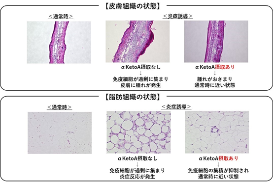 免疫細胞マクロファージに作用しアレルギー性接触皮膚炎や糖尿病の病態形成を抑制する