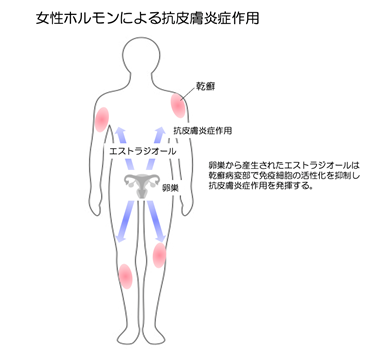 プレスリリース「女性ホルモンは乾癬を抑制する」のイメージ図