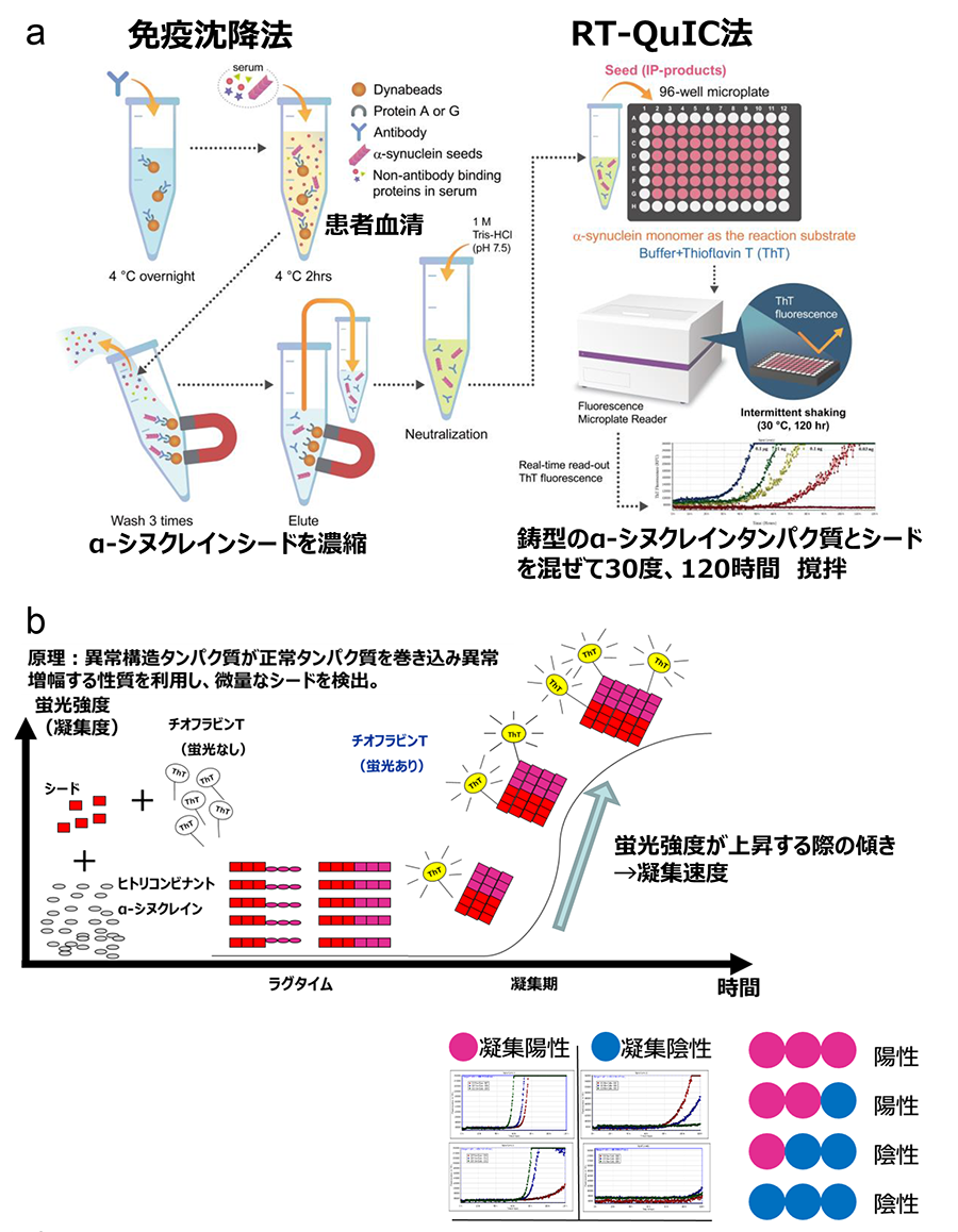 図1:血清IP/RT-QuICの方法と原理