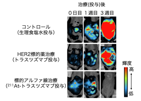 図4 漿液性がん腹膜播種のイメージング画像